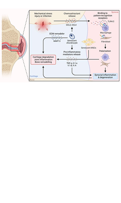 Exploiting senescence as a therapeutic target in osteoarthritis